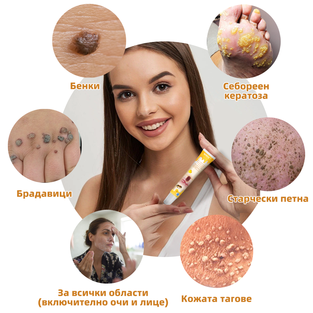 WREE™ крем за премахване на брадавици и кожни образувания с пчелна отрова❤️‍🔥(👨‍⚕Подходящ за всички типове кожа)🐝(🔥Последен ден на промоцията - 60% отстъпка)❤️‍🔥