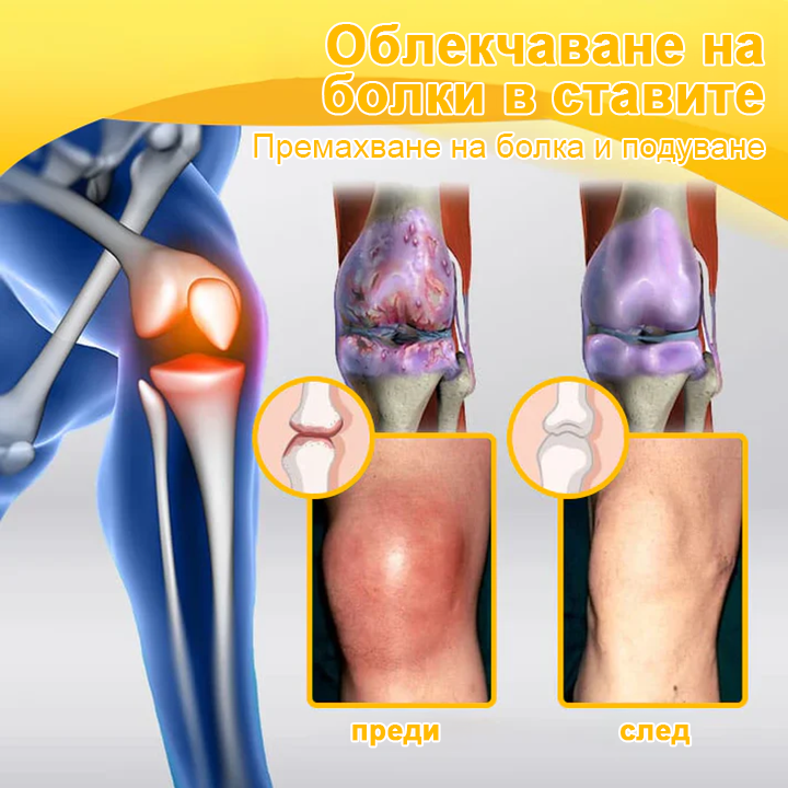 FATONG™ Крем за облекчаване на болката в костите с пчелна отрова (Специално за възрастни хора, препоръчван от Американската академия по ортопедична хирургия - AAOS)